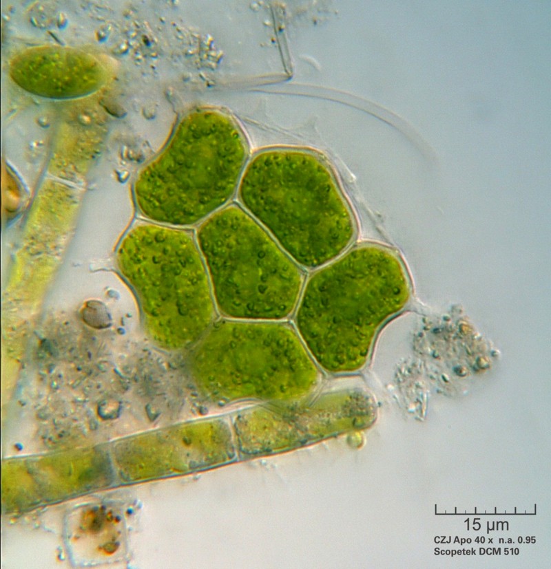 Pediastrum